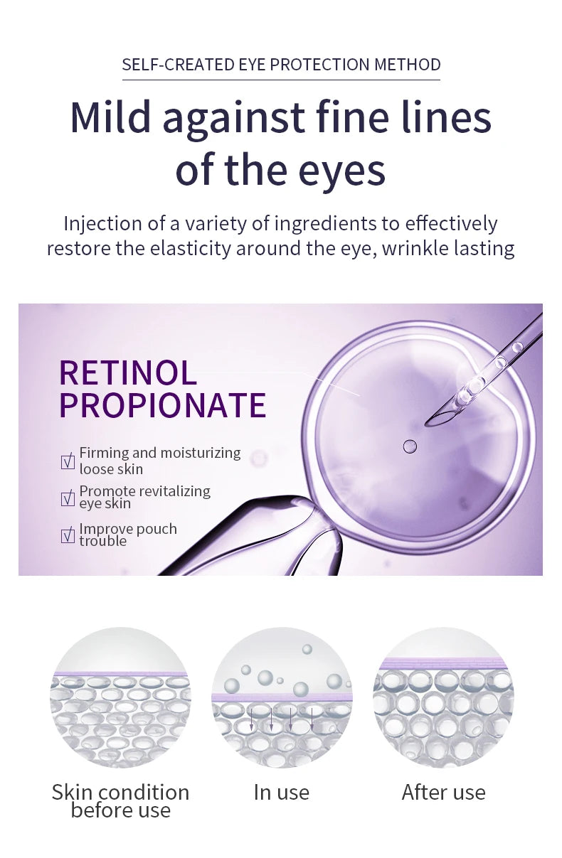 Anti Wrinkle Anti Dark Circle Eye Cream Roller Massager